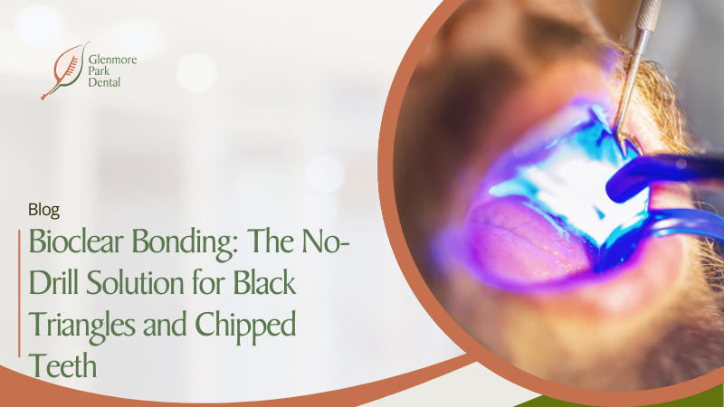 Bioclear Bonding: The No-Drill Solution for Black Triangles and Chipped Teeth 
