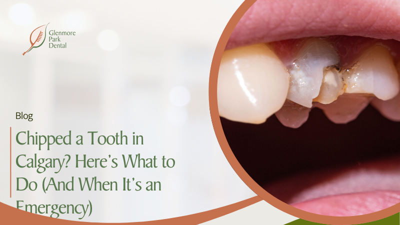 Chipped a Tooth in Calgary? Here’s What to Do (And When It’s an Emergency)