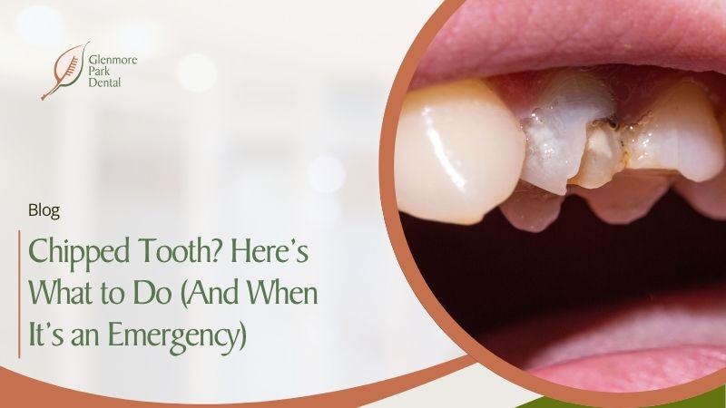 Chipped a Tooth in Calgary? Here’s What to Do (And When It’s an Emergency)