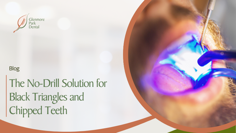 Bioclear Bonding: The No-Drill Solution for Black Triangles and Chipped Teeth 