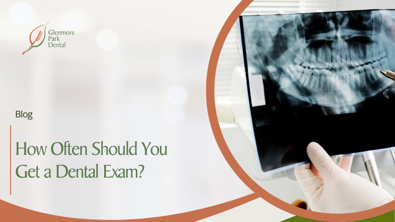 How Often Should You Get a Dental Exam? Advice from Your Calgary Dentist 