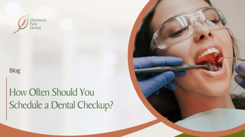 How Often Should You Schedule a Dental Checkup?