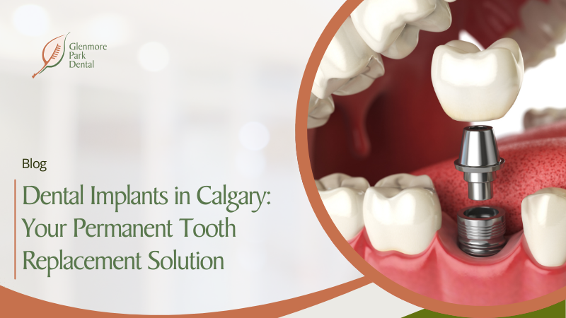 Dental Implants in Calgary: Your Permanent Tooth Replacement Solution 