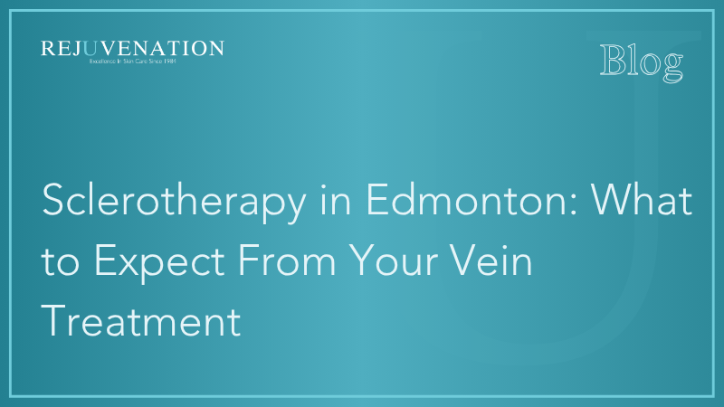Sclerotherapy in Edmonton: What to Expect From Your Vein Treatment