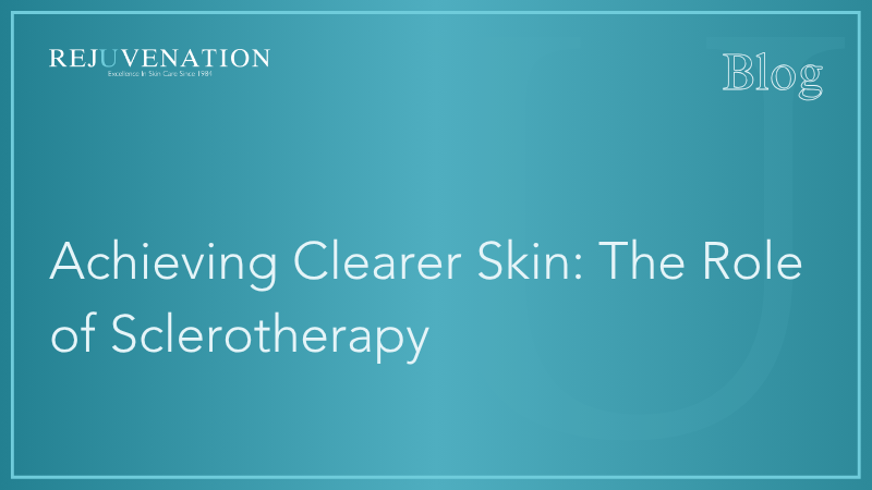 Achieving Clearer Skin: The Role of Sclerotherapy 