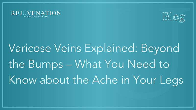 Varicose Veins Explained: Beyond the Bumps – What You Need to Know about the Ache in Your Legs