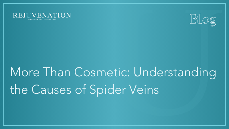 More Than Cosmetic: Understanding the Causes of Spider Veins