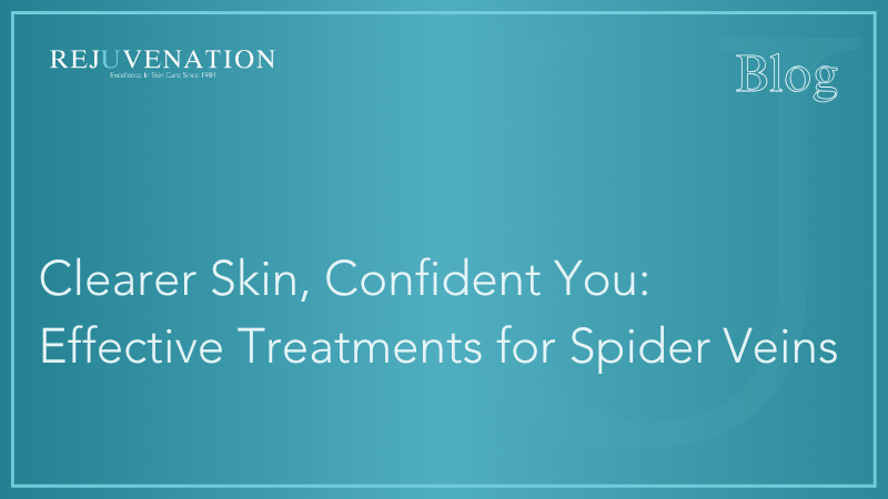 Clearer Skin, Confident You: Effective Treatments for Spider Veins