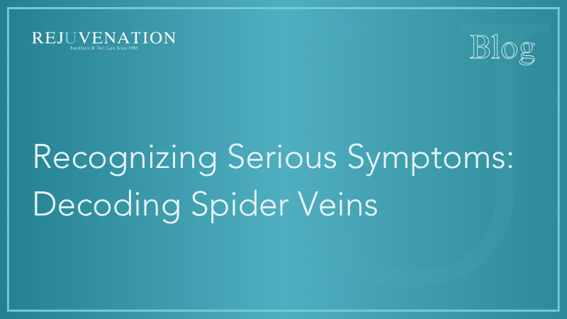 Recognizing Serious Symptoms: Decoding Spider Veins