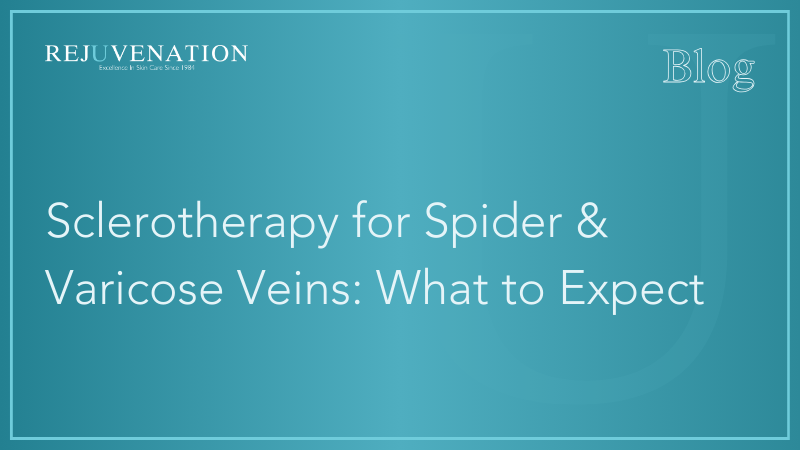 Sclerotherapy for Spider &amp; Varicose Veins: What to Expect