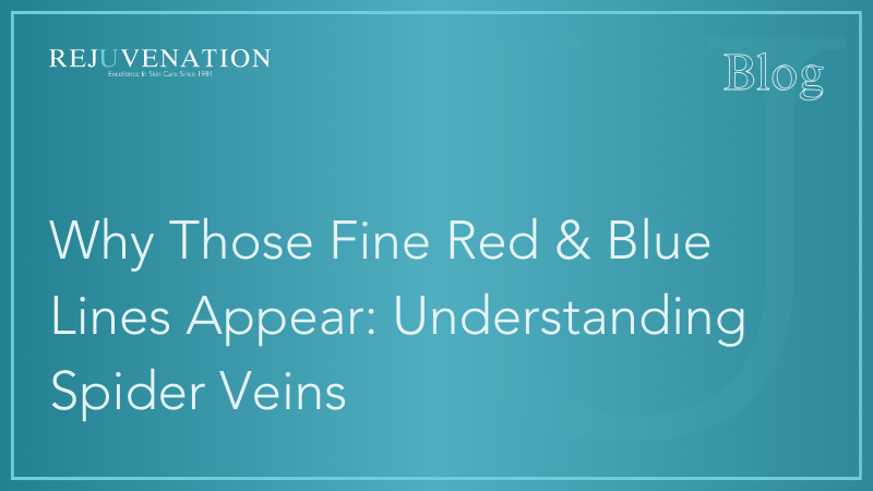 Why Those Fine Red &amp; Blue Lines Appear: Understanding Spider Veins