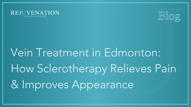 Vein Treatment in Edmonton: How Sclerotherapy Relieves Pain &amp; Improves Appearance