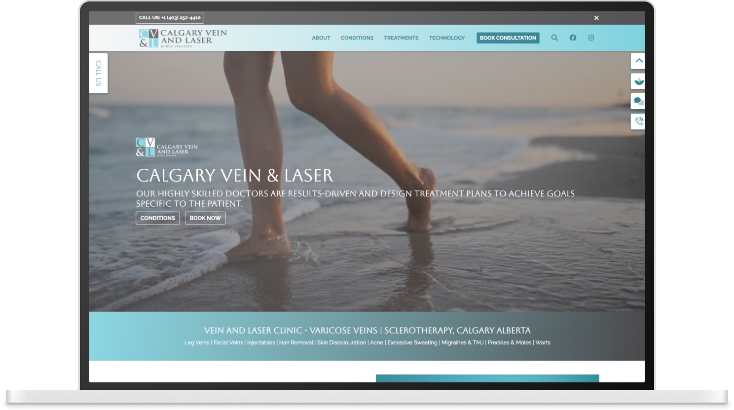 Calgary Vein & Laser Clinic