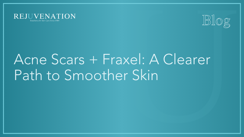 Acne Scars + Fraxel: A Clearer Path to Smoother Skin