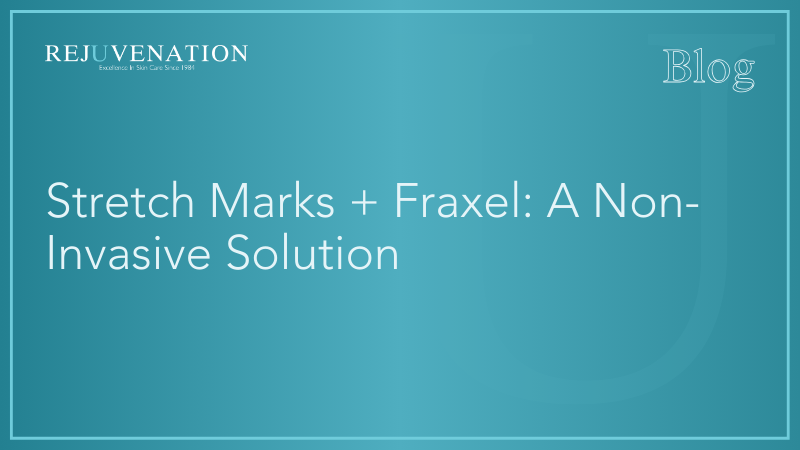Stretch Marks + Fraxel: A Non-Invasive Solution