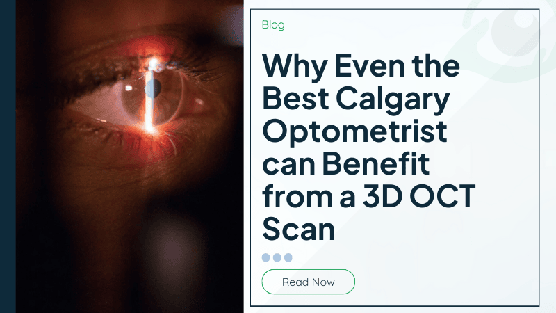 Why Even the Best Calgary Optometrist can Benefit from a 3D OCT Scan