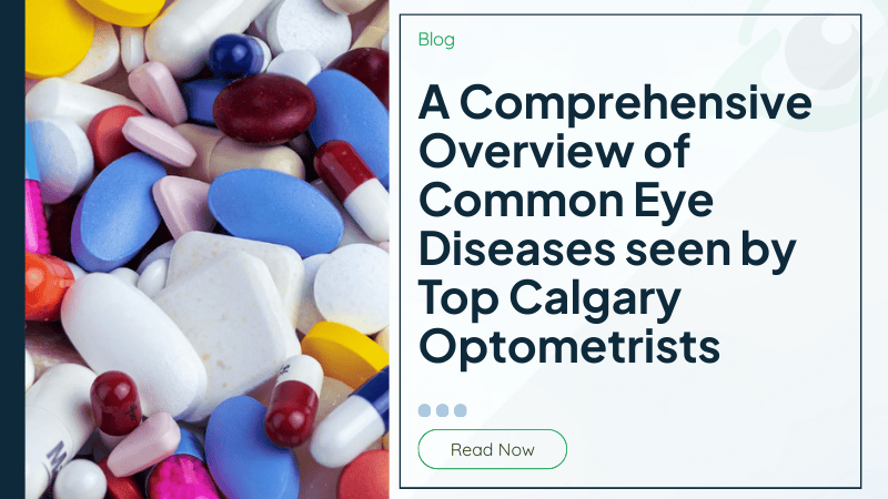A Comprehensive Overview of Common Eye Diseases seen by Top Calgary Optometrists