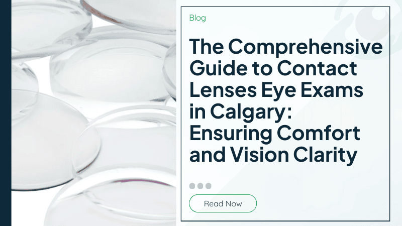 The Comprehensive Guide to Contact Lenses Eye Exams in Calgary: Ensuring Comfort and Vision Clarity