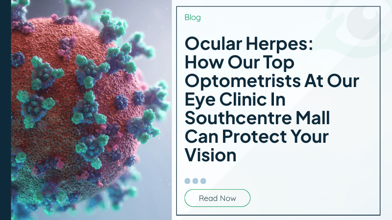 Ocular Herpes: How Our Top Optometrists At Our Eye Clinic In Southcentre Mall Can Protect Your Vision