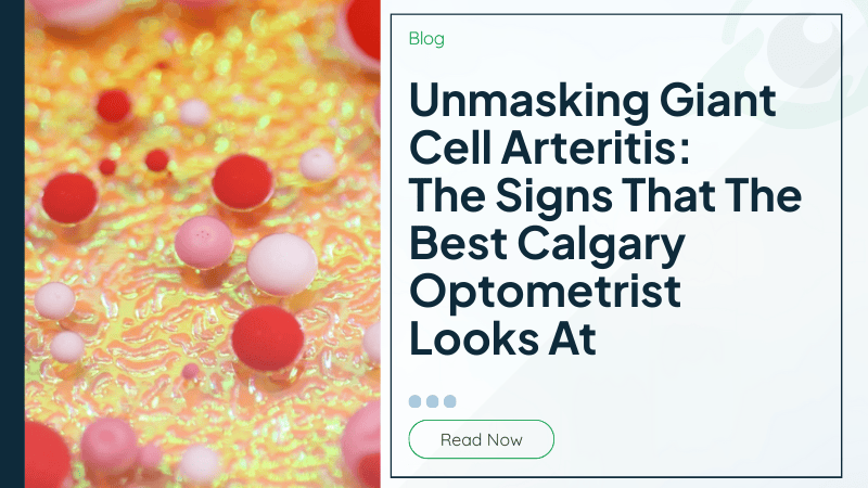 Unmasking Giant Cell Arteritis: The Signs That The Best Calgary Optometrist Looks At
