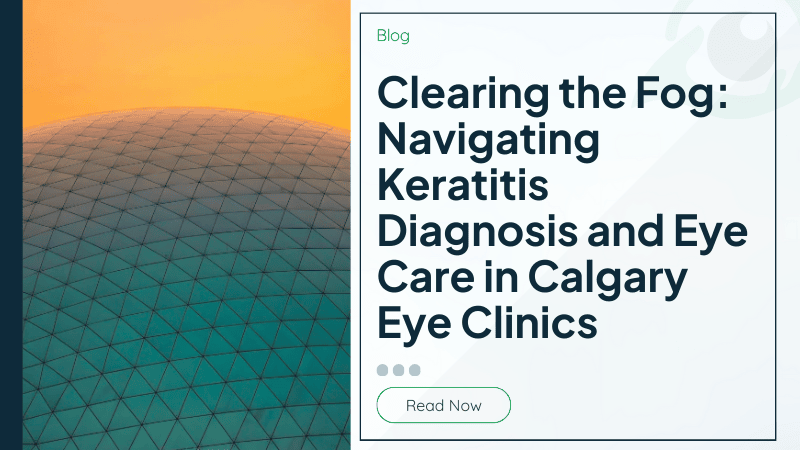 Clearing the Fog: Navigating Keratitis Diagnosis and Eye Care in Calgary Eye Clinics