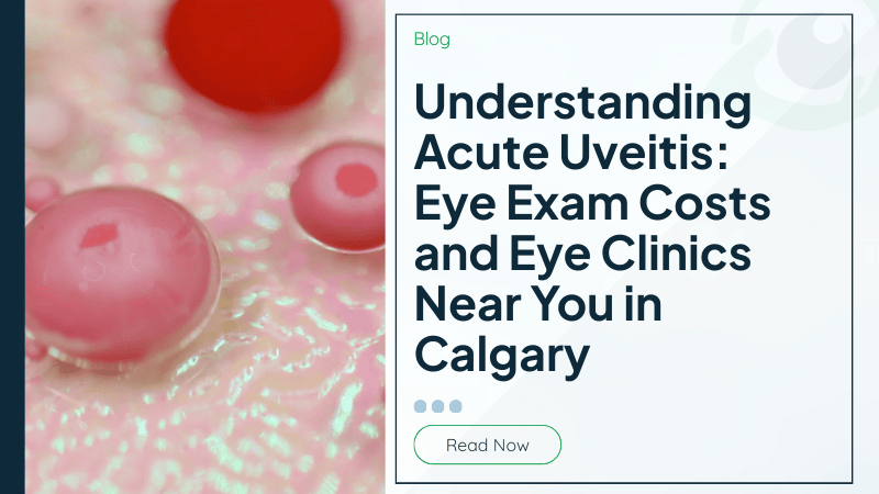 Understanding Acute Uveitis: Eye Exam Costs and Eye Clinics Near You in Calgary