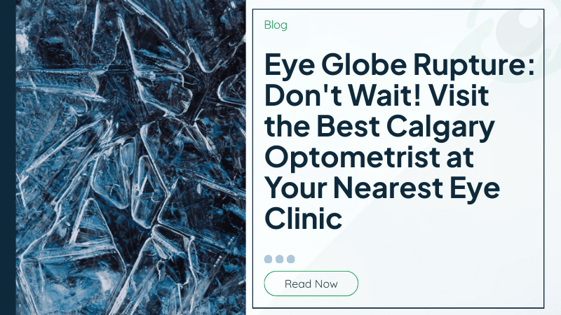 Eye Globe Rupture: Don&#039;t Wait! Visit the Best Calgary Optometrist at Your Nearest Eye Clinic