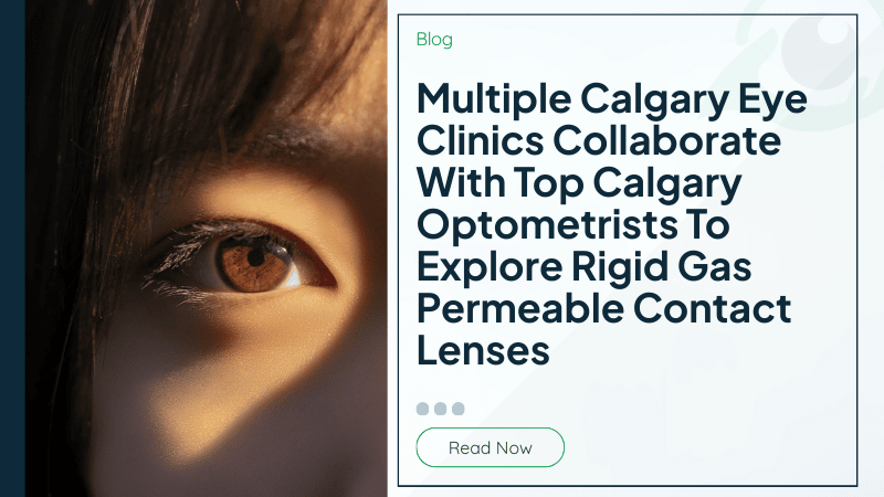 Multiple Calgary Eye Clinics Collaborate With Top Calgary Optometrists To Explore Rigid Gas Permeable Contact Lenses