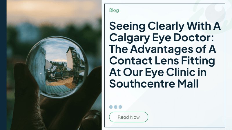 Seeing Clearly With A Calgary Eye Doctor: The Advantages of A Contact Lens Fitting At Our Eye Clinic in Southcentre Mall
