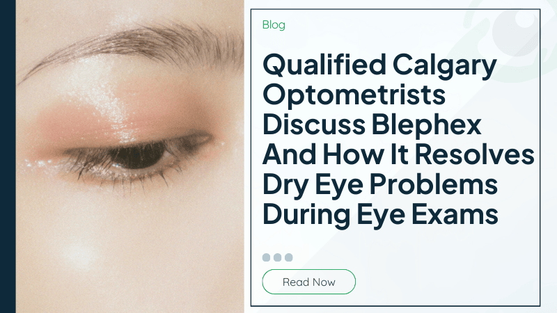 Qualified Calgary Optometrists Discuss Blephex And How It Resolves Dry Eye Problems During Eye Exams
