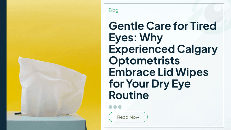 Gentle Care for Tired Eyes: Why Experienced Calgary Optometrists Embrace Lid Wipes for Your Dry Eye Routine