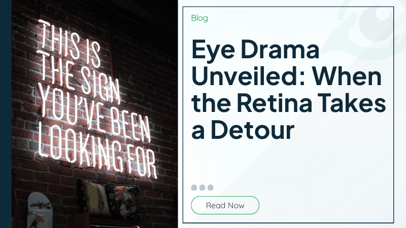 Eye Drama Unveiled: When the Retina Takes a Detour