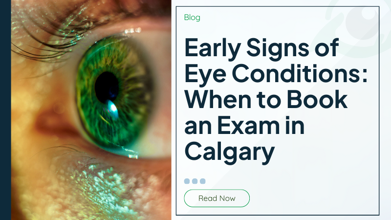 Early Signs of Eye Conditions: When to Book an Exam in Calgary