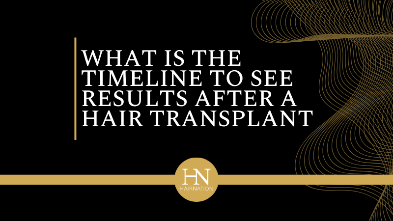 What Is the Timeline to See Full Results After My Hair Transplant Surgery?