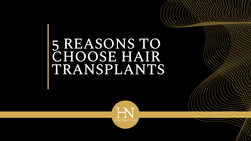 5 Reasons Men in Edmonton Choose Hair Transplants Over Other Hair Loss Solutions