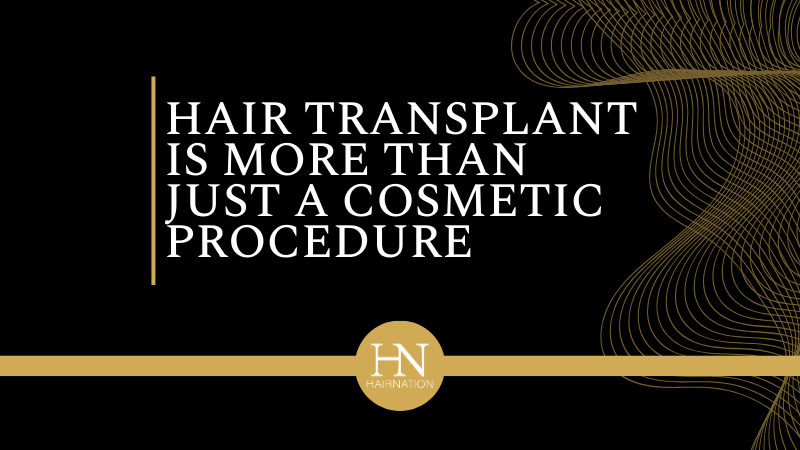 The Benefits of Hair Transplants: Why It’s More Than Just a Cosmetic Procedure