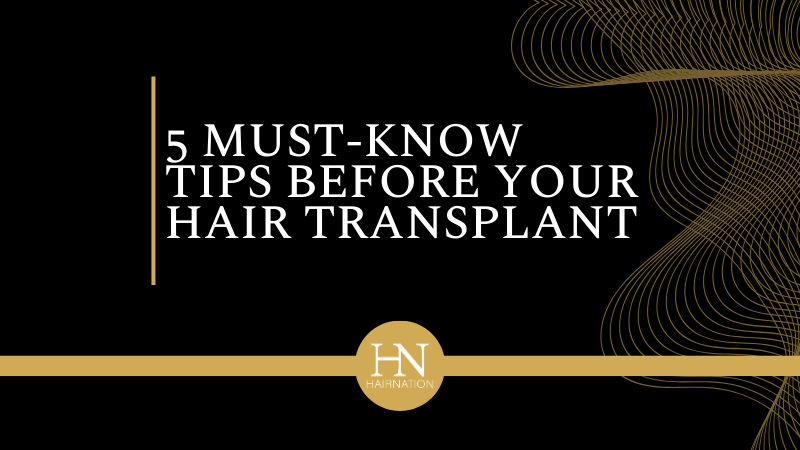 Edmonton Hair Transplant: 5 Must-Know Tips Before Your Hair Transplant