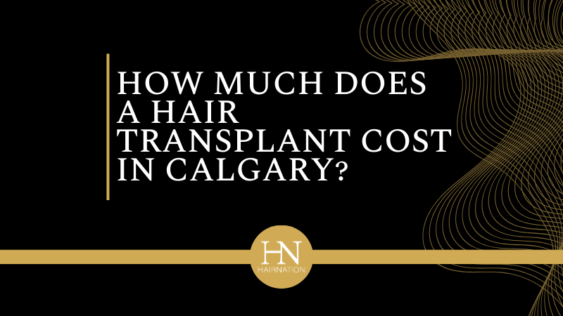 How Much Does a Hair Transplant Cost in Calgary? Understanding Your Options