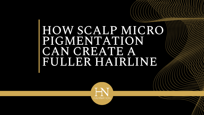 How Calgary Scalp Micropigmentation Can Create a Fuller Hairline