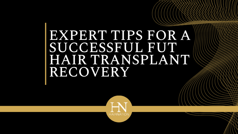 Edmonton FUT Treatment: Expert Tips for a Successful FUT Hair Transplant Recovery