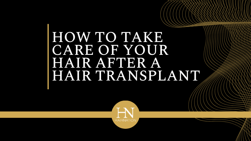 How To Take Care Of Your Hair After A Hair Transplant
