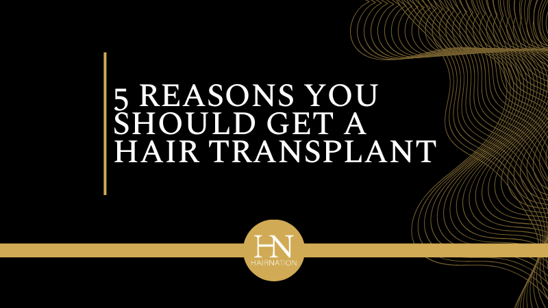 5 Reasons You Should Get A Hair Transplant