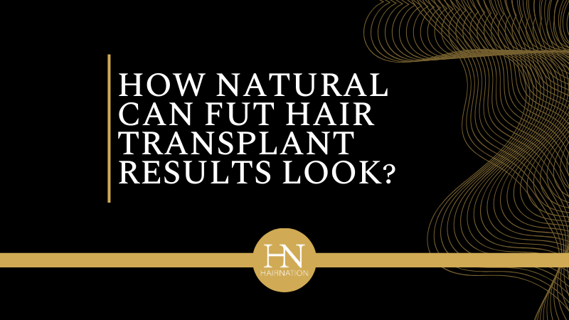 How Natural Can FUT Hair Transplant Results Look?