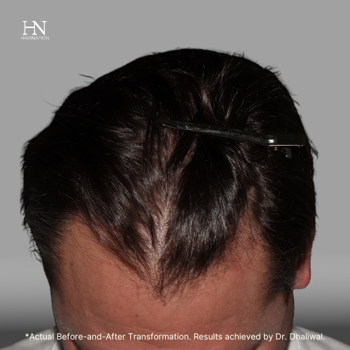 Set 6-HairNation-Before/After