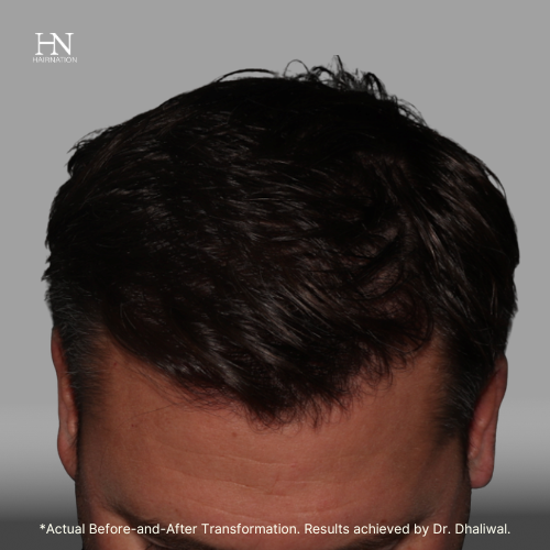 Set 6-HairNation-Before/After
