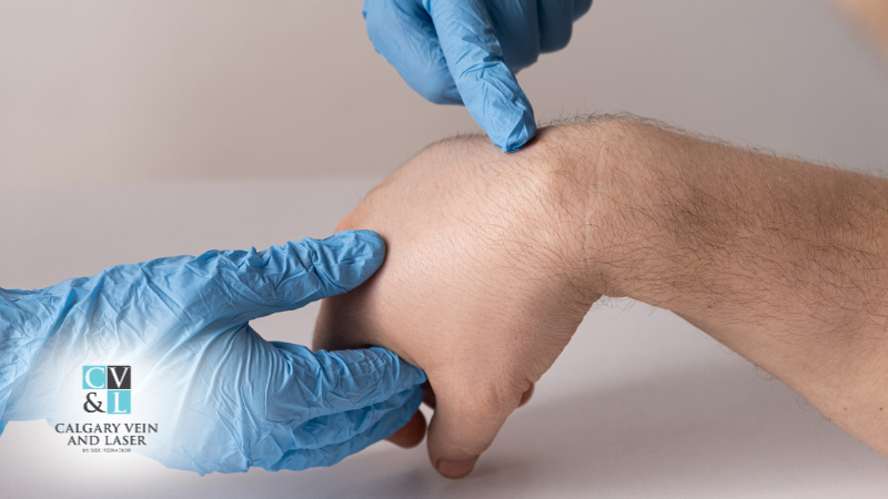 Is That Lump a Cyst or a Lipoma? Here’s How to Tell