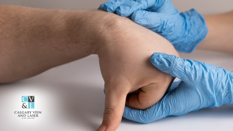 Lipomas and Weight Gain: Are They Related?