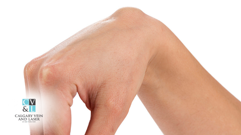 What That Bump on Your Skin Really Means: A Dermatology Guide