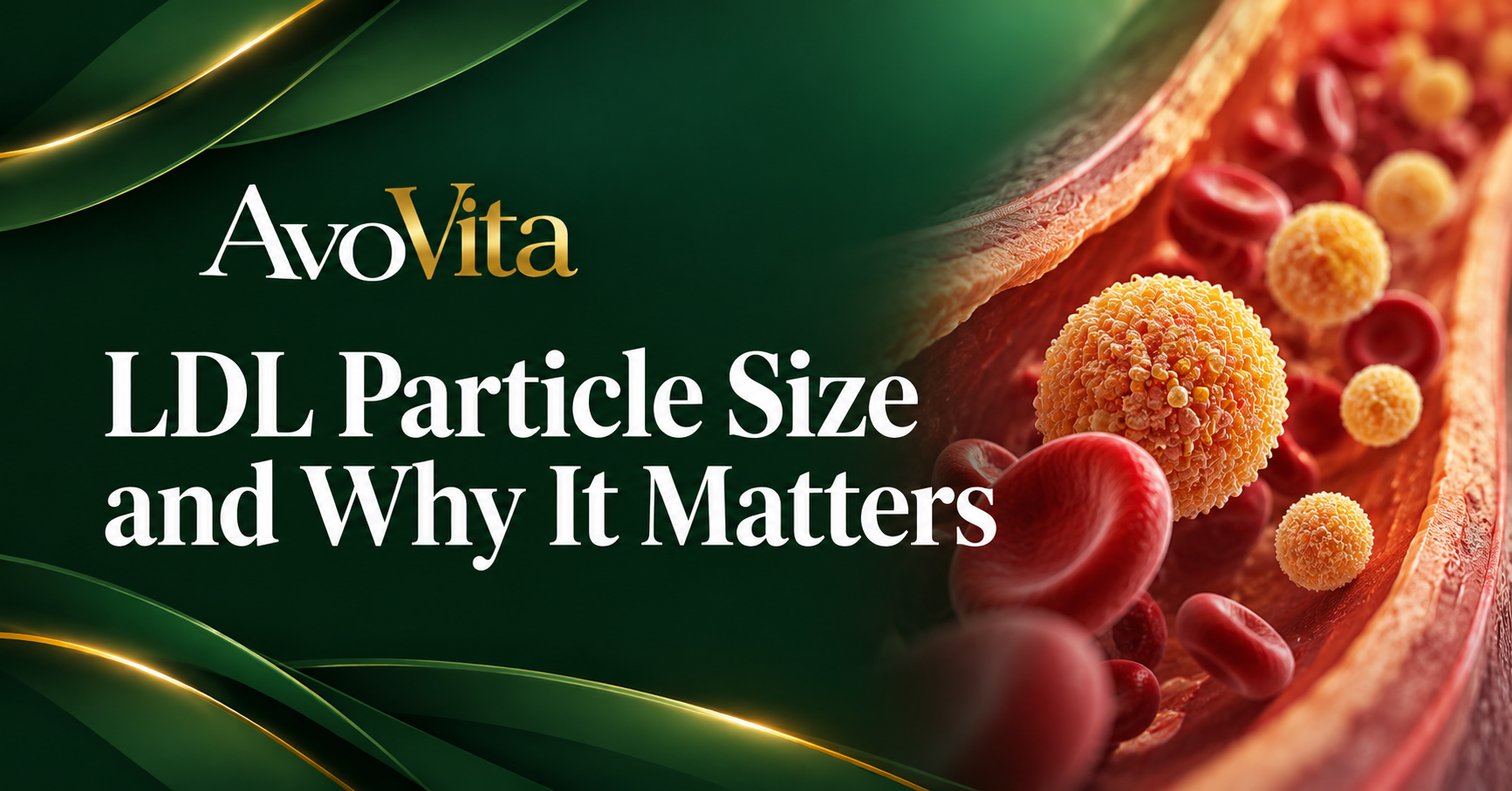 LDL Particle Size and Why It Matters