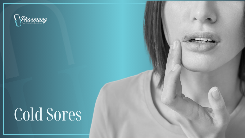 Cold Sores
